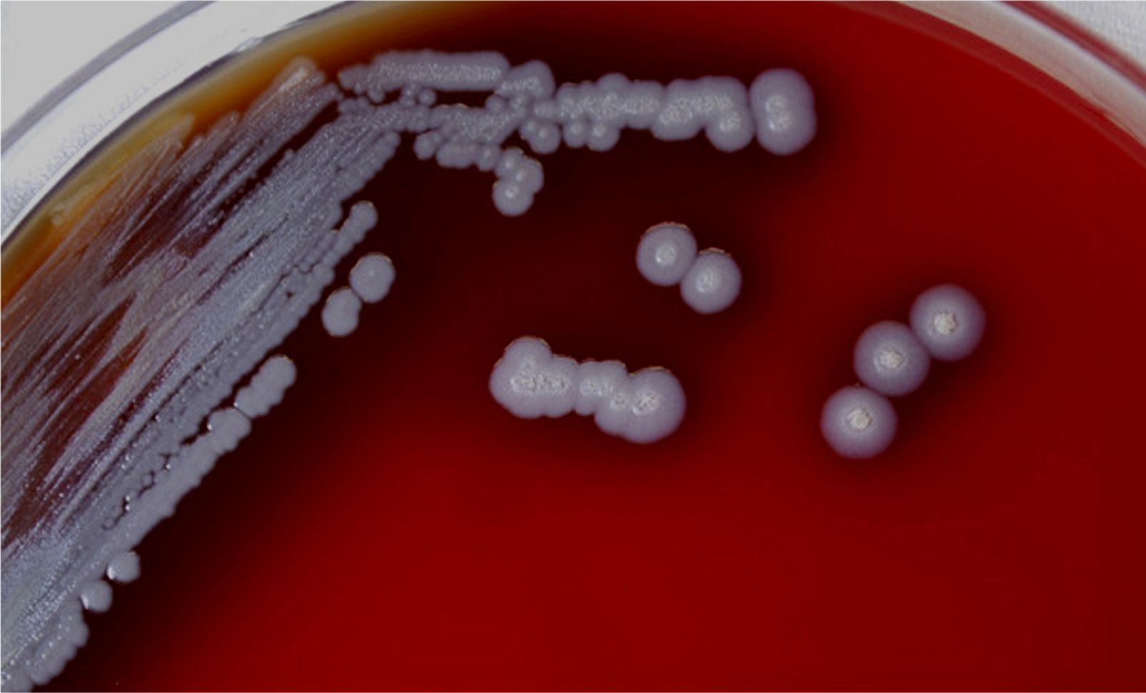 CDC varuje pred smrtiacimi baktériami